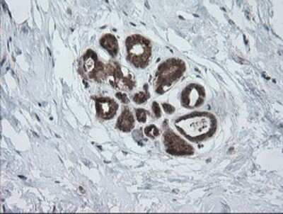 Immunohistochemistry: PI 3-Kinase p110 gamma Antibody (OTI2B1) [NBP2-46411]