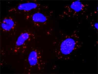 Proximity Ligation Assay: PI 3-Kinase p110 gamma Antibody (2G3) [H00005294-M02]