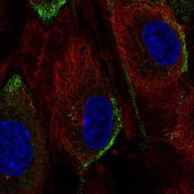 Immunocytochemistry/ Immunofluorescence: PI 3-Kinase p110 gamma Antibody [NBP2-57013]