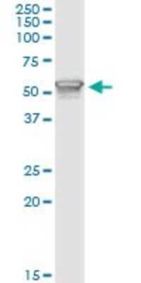 Immunoprecipitation: PI 3-Kinase p85 alpha Antibody (3A10) [H00005295-M01]