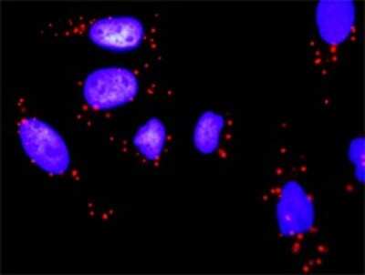 Proximity Ligation Assay: PI 3-Kinase p85 alpha Antibody (3A10) [H00005295-M01]