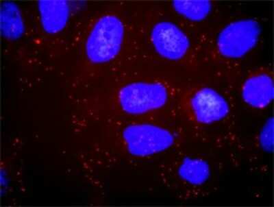 Proximity Ligation Assay: PI 3-Kinase p85 alpha Antibody (3A10) [H00005295-M01]