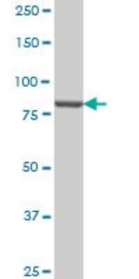 Western Blot: PI 3-Kinase p85 alpha Antibody (3A10) [H00005295-M01]