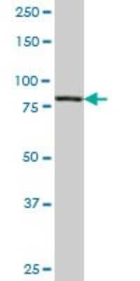 Western Blot: PI 3-Kinase p85 alpha Antibody (3C11) [H00005295-M03]