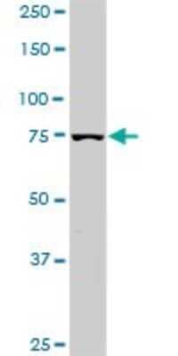 Western Blot: PI 3-Kinase p85 alpha Antibody (3C11) [H00005295-M03]