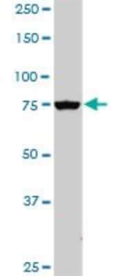 Western Blot: PI 3-Kinase p85 alpha Antibody (3C11) [H00005295-M03]