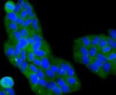 Immunocytochemistry/ Immunofluorescence: PI 3-Kinase p85 alpha Antibody (A3-D0) [NBP2-67058]