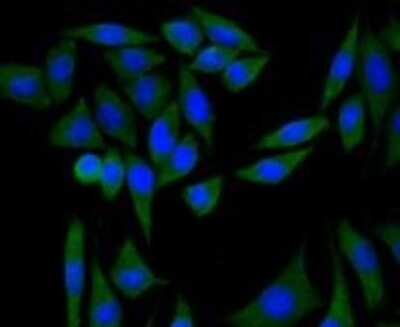 Immunocytochemistry/ Immunofluorescence: PI 3-Kinase p85 alpha Antibody (A3-D0) [NBP2-67058]