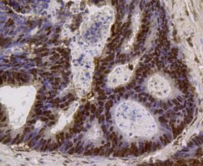 Immunohistochemistry-Paraffin: PI 3-Kinase p85 alpha Antibody (A3-D0) [NBP2-67058]