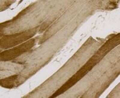 Immunohistochemistry-Paraffin: PI 3-Kinase p85 alpha Antibody (A3-D0) [NBP2-67058]