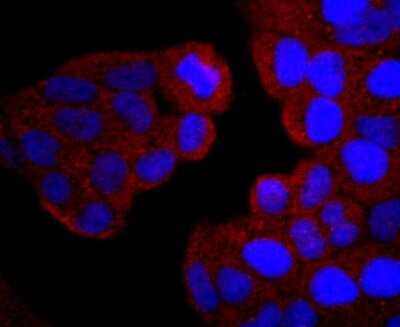 Immunocytochemistry/ Immunofluorescence: PI 3-Kinase p85 alpha Antibody (SU04-07) [NBP2-67488]