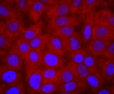 Immunocytochemistry/ Immunofluorescence: PI 3-Kinase p85 alpha Antibody (SU04-07) [NBP2-67488]