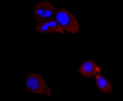 Immunocytochemistry/ Immunofluorescence: PI 3-Kinase p85 alpha Antibody (SU04-07) [NBP2-67488]