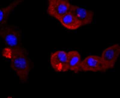 Immunocytochemistry/ Immunofluorescence: PI 3-Kinase p85 alpha Antibody (SU04-07) [NBP2-67488]
