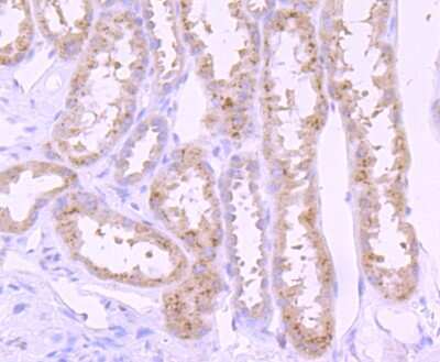Immunohistochemistry-Paraffin: PI 3-Kinase p85 alpha Antibody (SU04-07) [NBP2-67488]