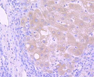 Immunohistochemistry-Paraffin: PI 3-Kinase p85 alpha Antibody (SU04-07) [NBP2-67488]