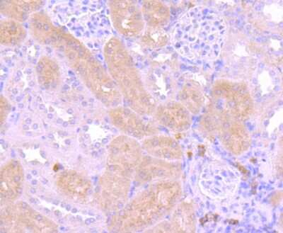 Immunohistochemistry-Paraffin: PI 3-Kinase p85 alpha Antibody (SU04-07) [NBP2-67488]