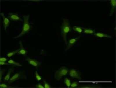 Immunocytochemistry/ Immunofluorescence: PI4K2A Antibody [H00055361-D01P]