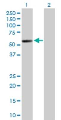 Western Blot: PI4K2A Antibody [H00055361-D01P]