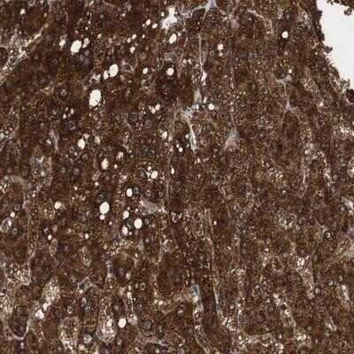 Immunohistochemistry-Paraffin: PI4KB/PI4KIII beta Antibody [NBP1-80907]
