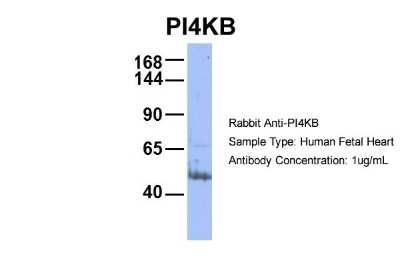 Western Blot: PI4KB/PI4KIII beta Antibody [NBP1-56440]