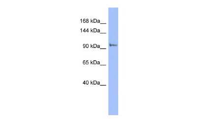 Western Blot: PI4KB/PI4KIII beta Antibody [NBP1-56440]