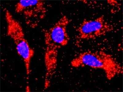Proximity Ligation Assay: PIAS1 Antibody (4A4) [H00008554-M06]
