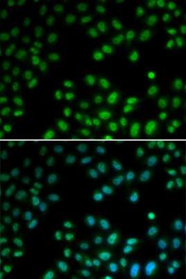 Immunocytochemistry/ Immunofluorescence: PIAS1 Antibody - BSA Free [NBP2-94354]
