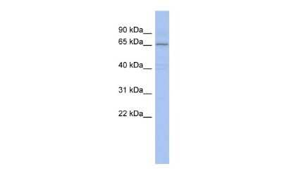 Western Blot: PIAS1 Antibody [NBP2-82305]