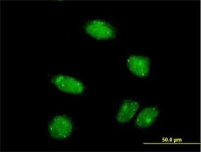 Immunocytochemistry/ Immunofluorescence: PIAS2 Antibody (1F7) [H00009063-M01]