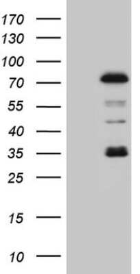 Western Blot: PIAS2 Antibody (OTI2B5) [NBP2-46394]
