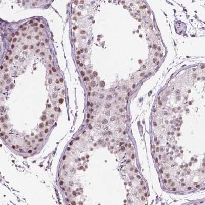 Immunohistochemistry-Paraffin: PIAS2 Antibody [NBP2-49571]