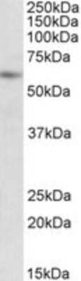 Western Blot: PIAS2 Antibody [NBP1-52022]