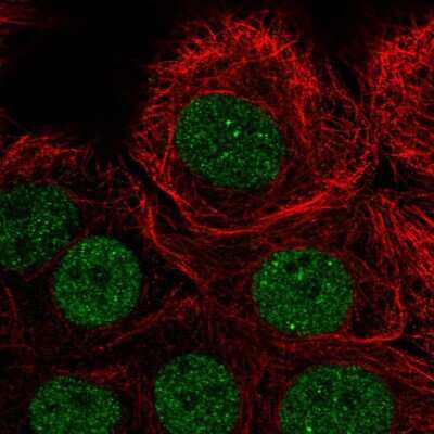 Immunocytochemistry/ Immunofluorescence: PIAS3 Antibody [NBP2-57238]