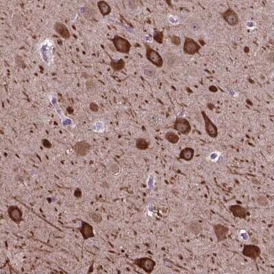Immunohistochemistry: PIAS3 Antibody [NBP2-48503]