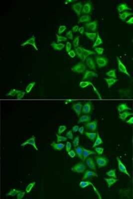 Immunocytochemistry/ Immunofluorescence: PIB5PA Antibody - BSA Free [NBP2-94054]