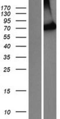 Western Blot: PIB5PA Overexpression Lysate [NBP2-10735]