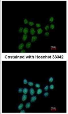 Immunocytochemistry/ Immunofluorescence: PIBF1 Antibody [NBP2-19823]