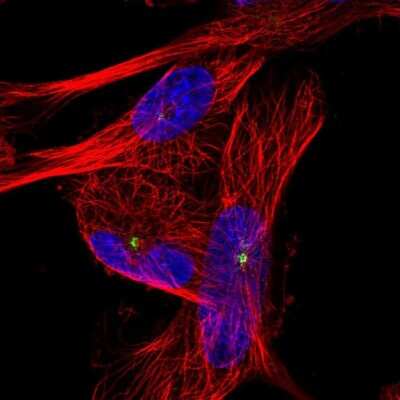 Immunocytochemistry/ Immunofluorescence: PIBF1 Antibody [NBP2-56805]