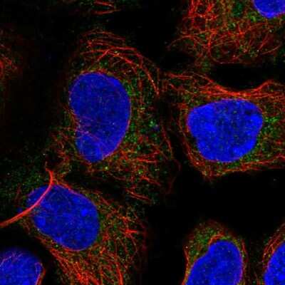 Immunocytochemistry/ Immunofluorescence: PICK1 Antibody [NBP2-57239]