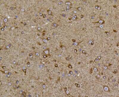 Immunohistochemistry-Paraffin: PIEZO1 Antibody (2-10) [NBP2-75617]