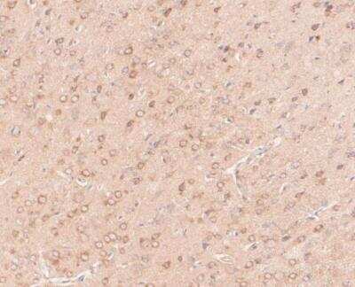 Immunohistochemistry-Paraffin: PIEZO1 Antibody (2-10) [NBP2-75617]