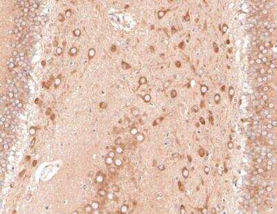 Immunohistochemistry-Paraffin: PIEZO1 Antibody (2-10) [NBP2-75617]