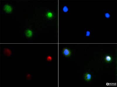 Immunocytochemistry/ Immunofluorescence: PIEZO2 Antibody - BSA Free [NBP1-78538]