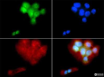 Immunocytochemistry/Immunofluorescence Staining of PIEZO2 in A431 Cells