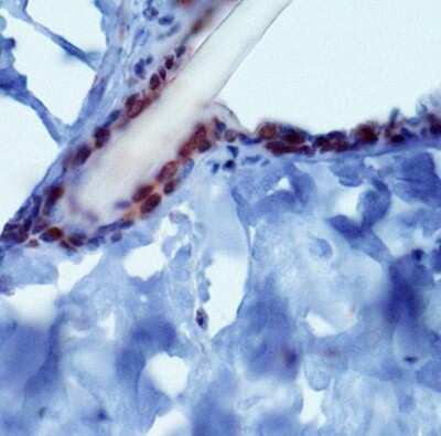 Immunohistochemistry: PIEZO2 Antibody - BSA Free [NBP1-78538]