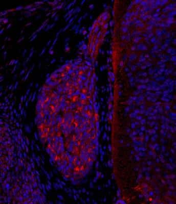 Immunohistochemical Analysis of PIEZO2 in Paraffin Embedded Mouse Dorsal Root Ganglion
