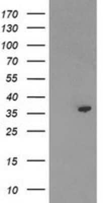Western Blot: PIG3 Antibody (OTI3B11) [NBP2-01301]