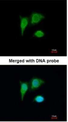 Immunocytochemistry/ Immunofluorescence: PIG3 Antibody [NBP1-33237]