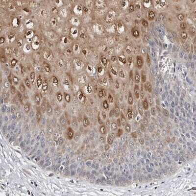 Immunohistochemistry-Paraffin: PIG3 Antibody [NBP1-87274]